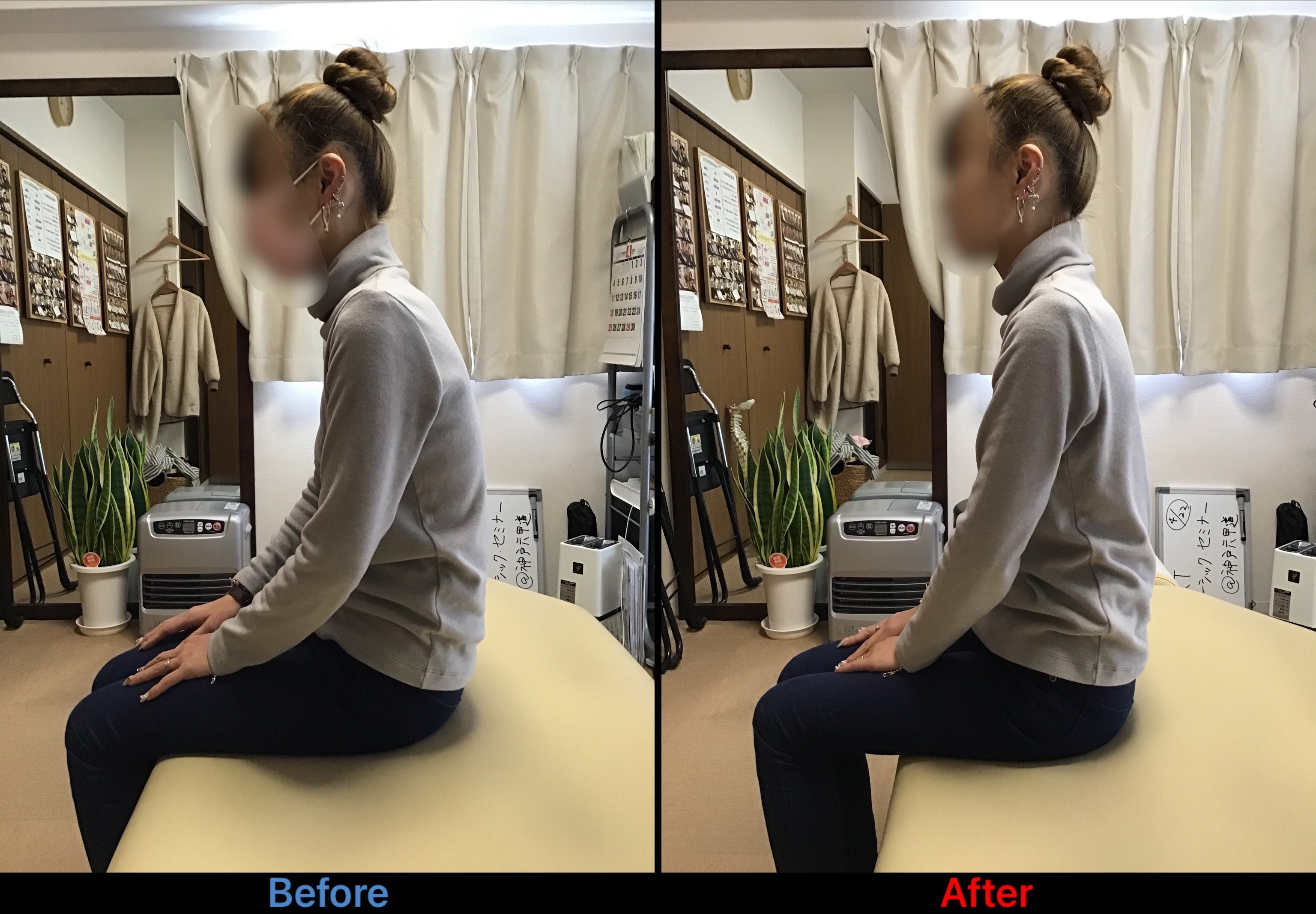 座り姿勢の施術前後比較写真（猫背が改善している様子。お客様同意のうえ、お顔にはぼかし加工をしています）